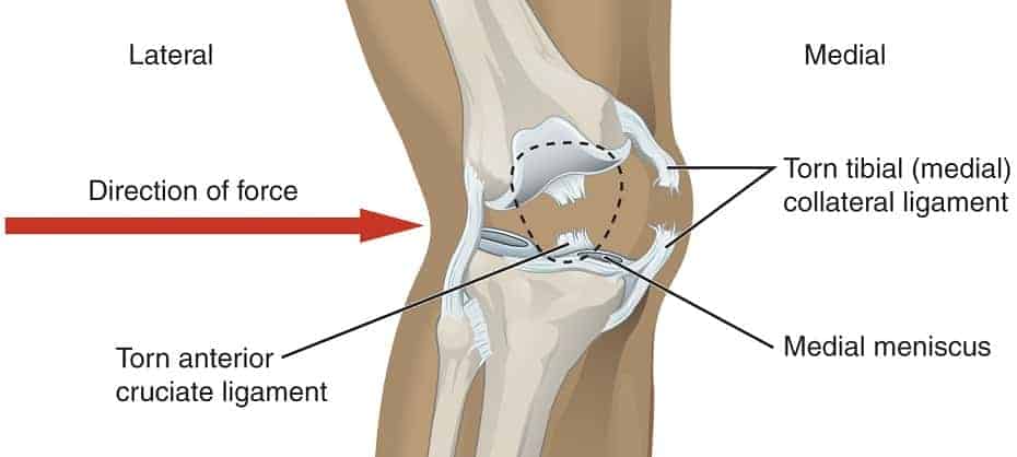 golf injuries knee