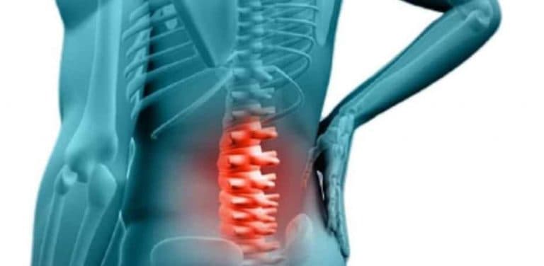 What Are the Most Common Golf Back Injuries and How to Avoid Them ...